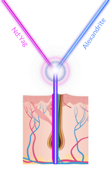 SPX-technology-illustration-1.png